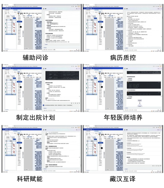 引入AI輔助診療系統。德格縣人民醫院供圖
